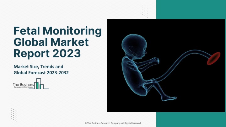 fetal monitoring global market report 2023
