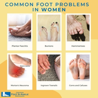 Common Foot Problems in Women