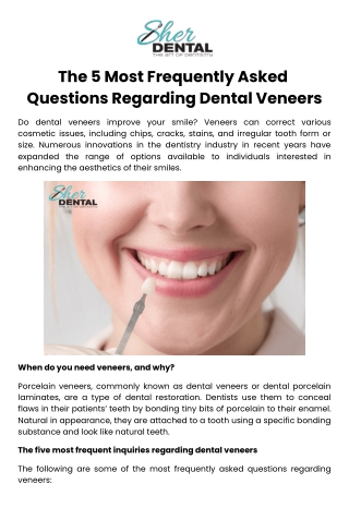 The 5 Most Frequently Asked Questions Regarding Dental Veneers