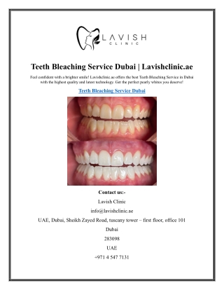 Teeth Bleaching Service Dubai  Lavishclinic.ae