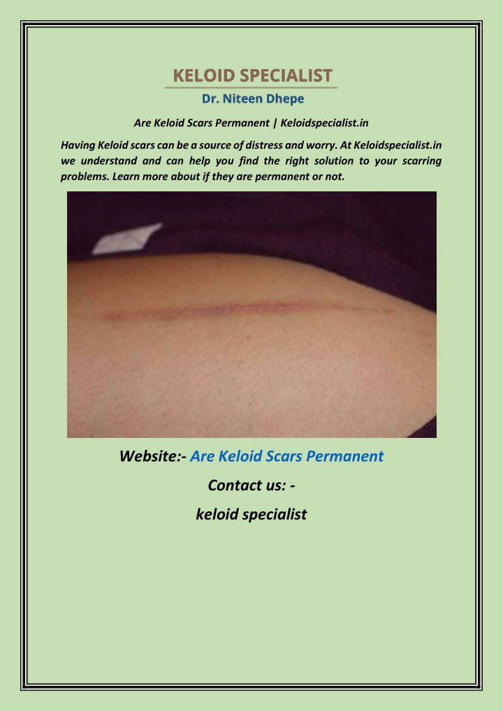 are keloid scars permanent keloidspecialist in