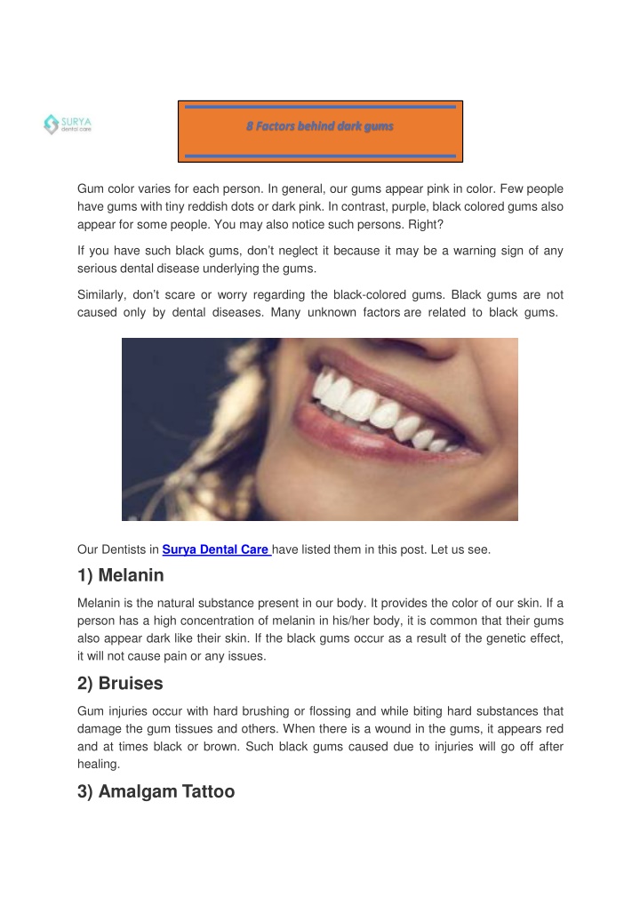 8 factors behind dark gums