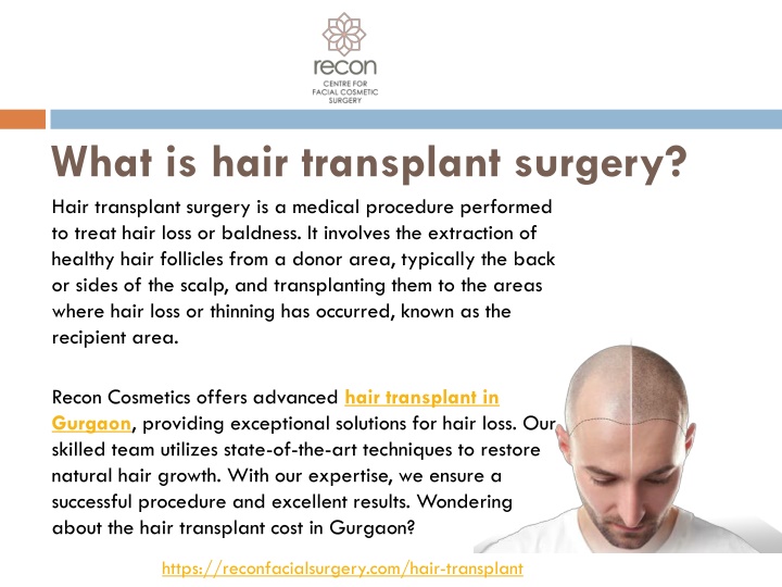 what is hair transplant surgery
