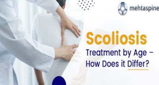 Scoliosis Treatment by Age: A Comprehensive Guide | Mehta Spine