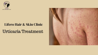 lifero hair skin clinic urticaria treatment