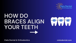 How Do Braces Align Your Teeth?