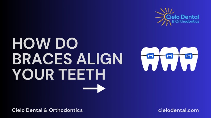 how do braces align your teeth