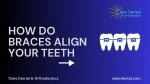How Do Braces Align Your Teeth? - slide 1