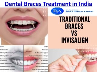 Orthodontic Dental Clinic in India For Advanced Oral Treatments
