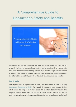 A Comprehensive Guide to Liposuction's Safety and Benefits