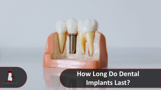 What is the lifespan of dental implants?