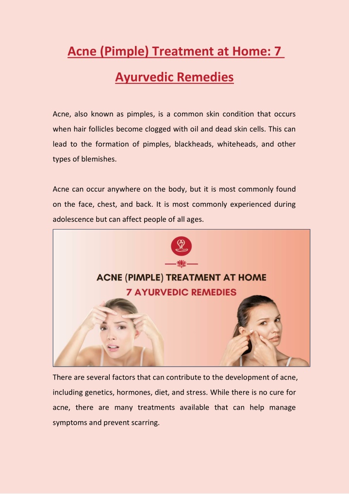 acne pimple treatment at home 7