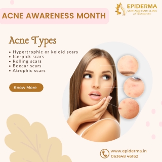 Acne Types | Best Skin Clinic in Jayanagar, Bangalore | Epiderma Skin Clinic