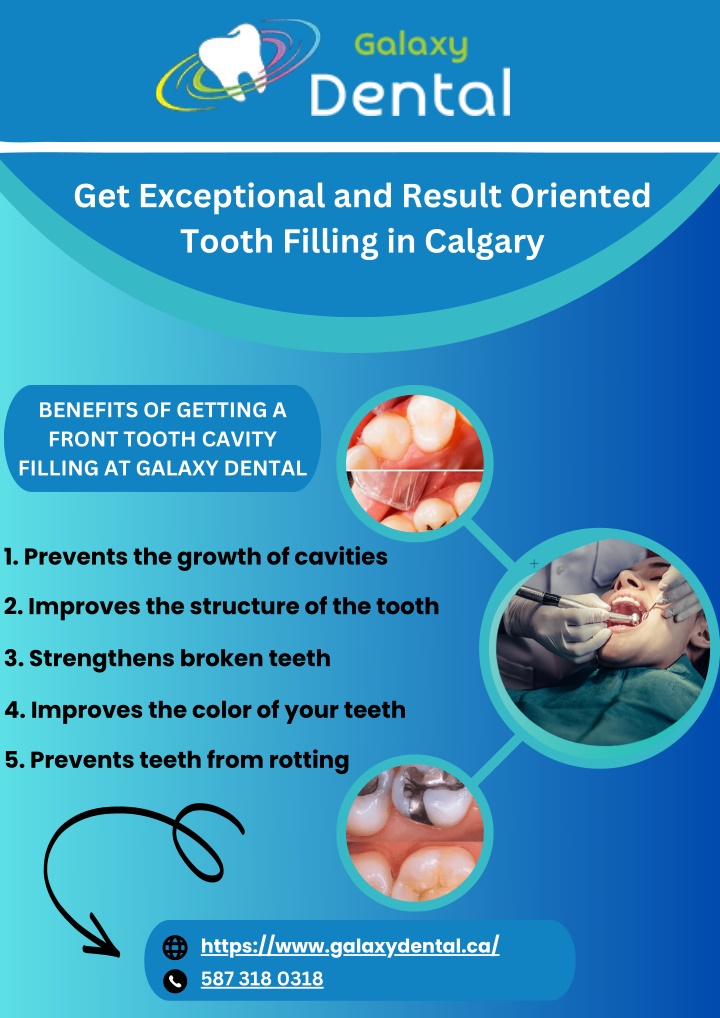get exceptional and result oriented tooth filling