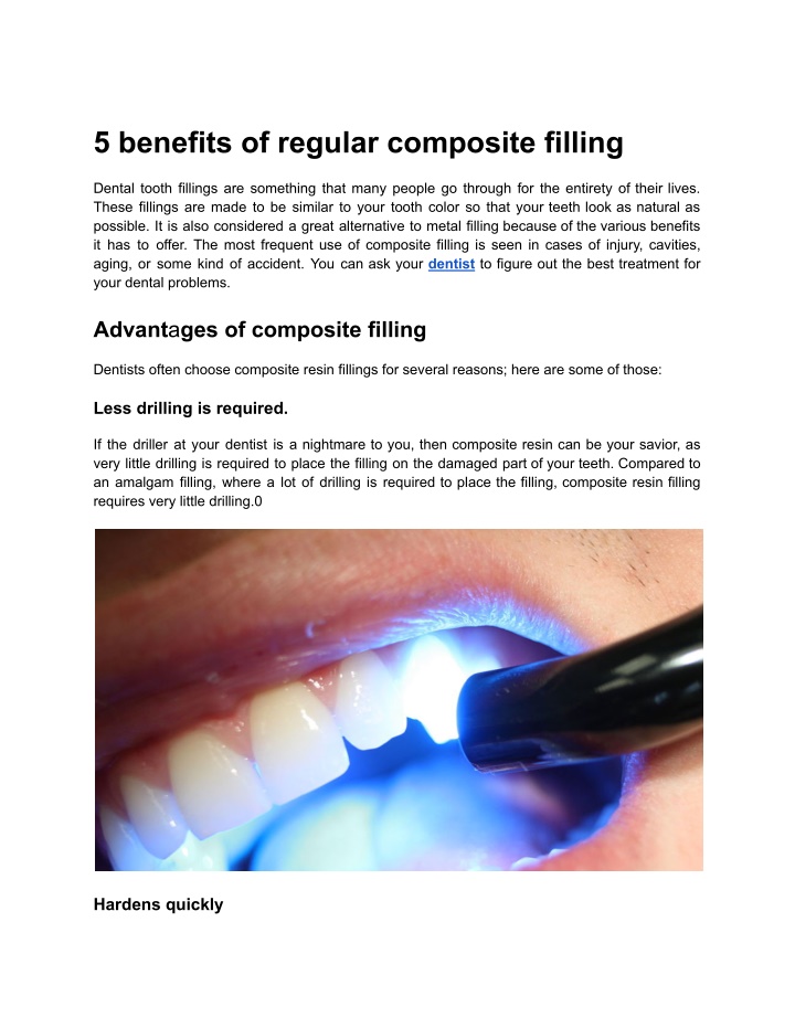 5 benefits of regular composite filling