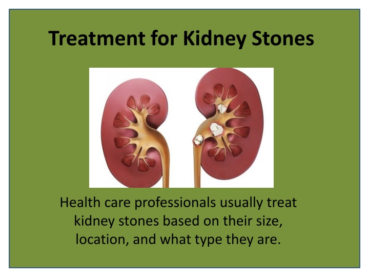 treatment for kidney stones
