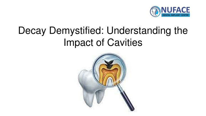 decay demystified understanding the impact of cavities