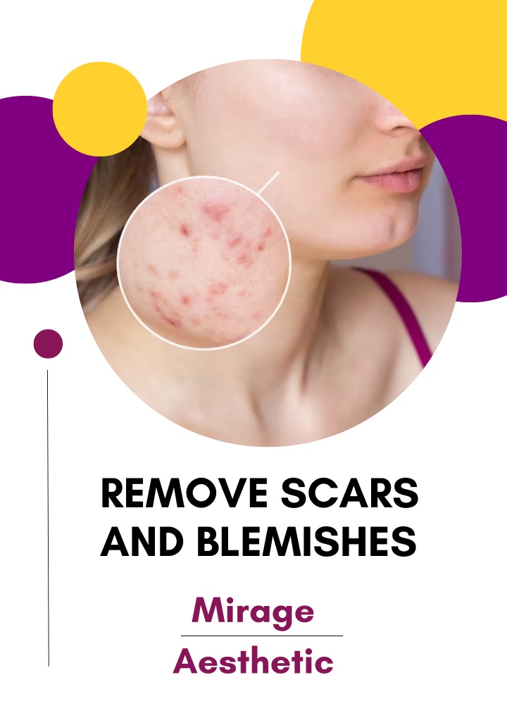 remove scars and blemishes
