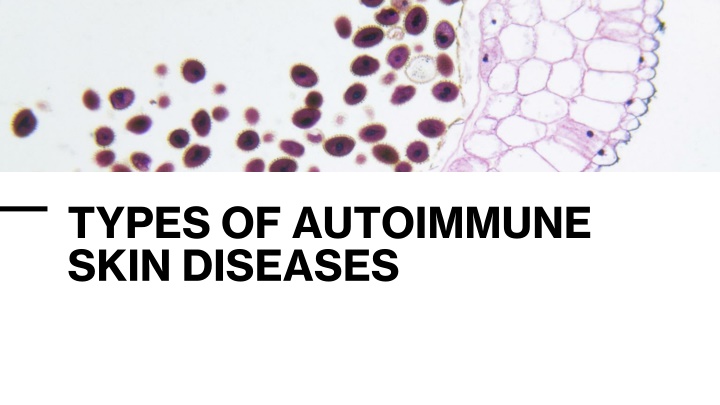 types of autoimmune skin diseases