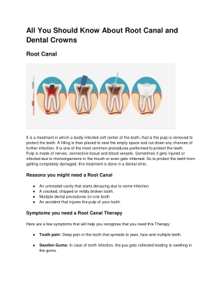 All You Should Know About Root Canal and Dental Crowns