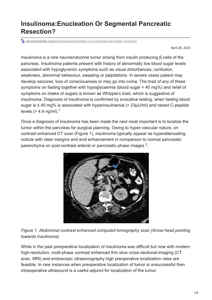 insulinoma enucleation or segmental pancreatic