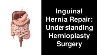 Inguinal Hernia Hernioplasty Surgery