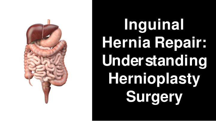 inguinal hernia repair