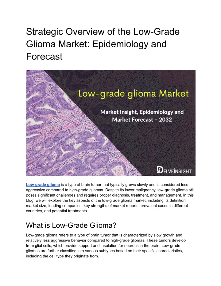 strategic overview of the low grade glioma market