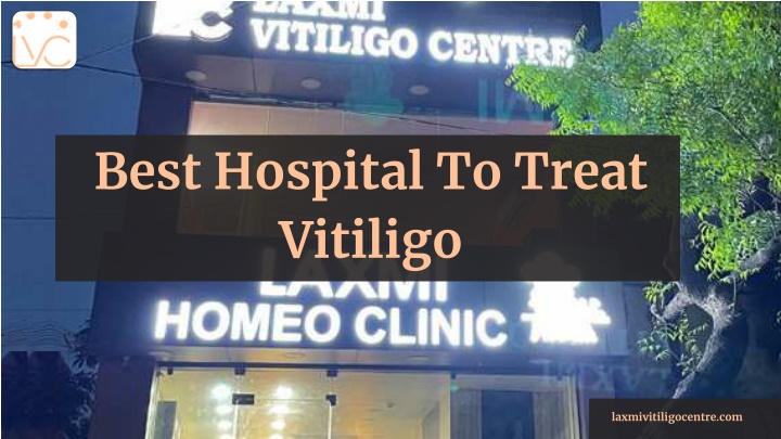 best hospital to treat vitiligo