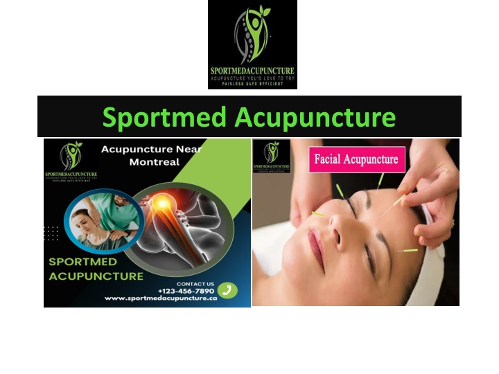 sportmed acupuncture