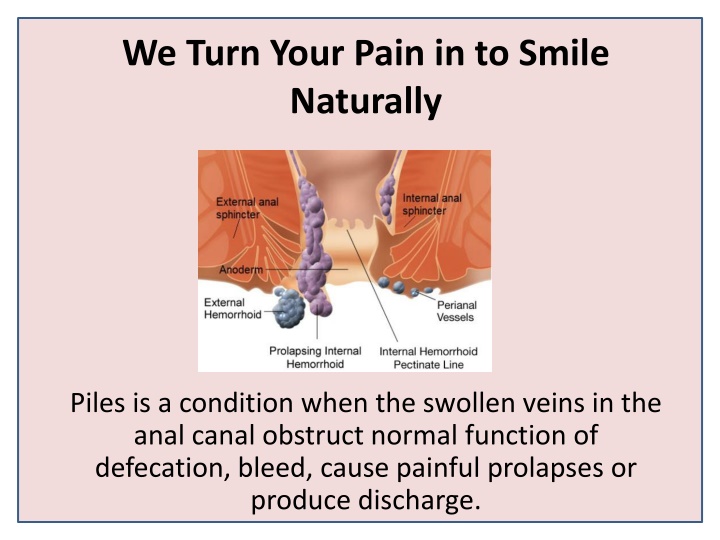 we turn your pain in to smile naturally