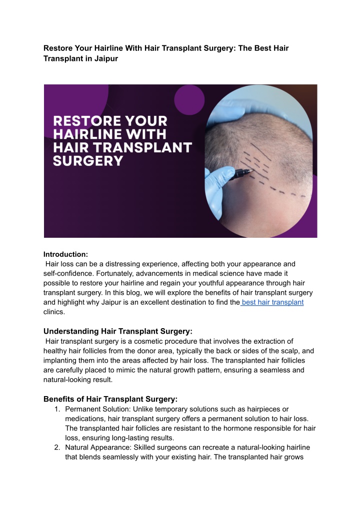 restore your hairline with hair transplant