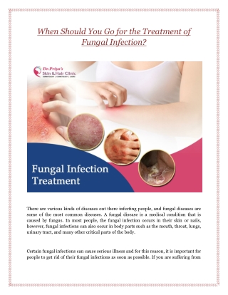 when should you go for the treatment of fungal