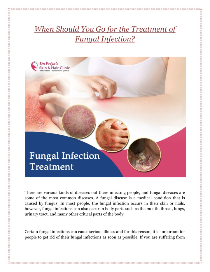 when should you go for the treatment of fungal