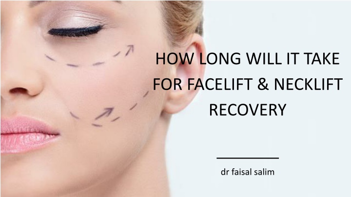 how long will it take for facelift necklift
