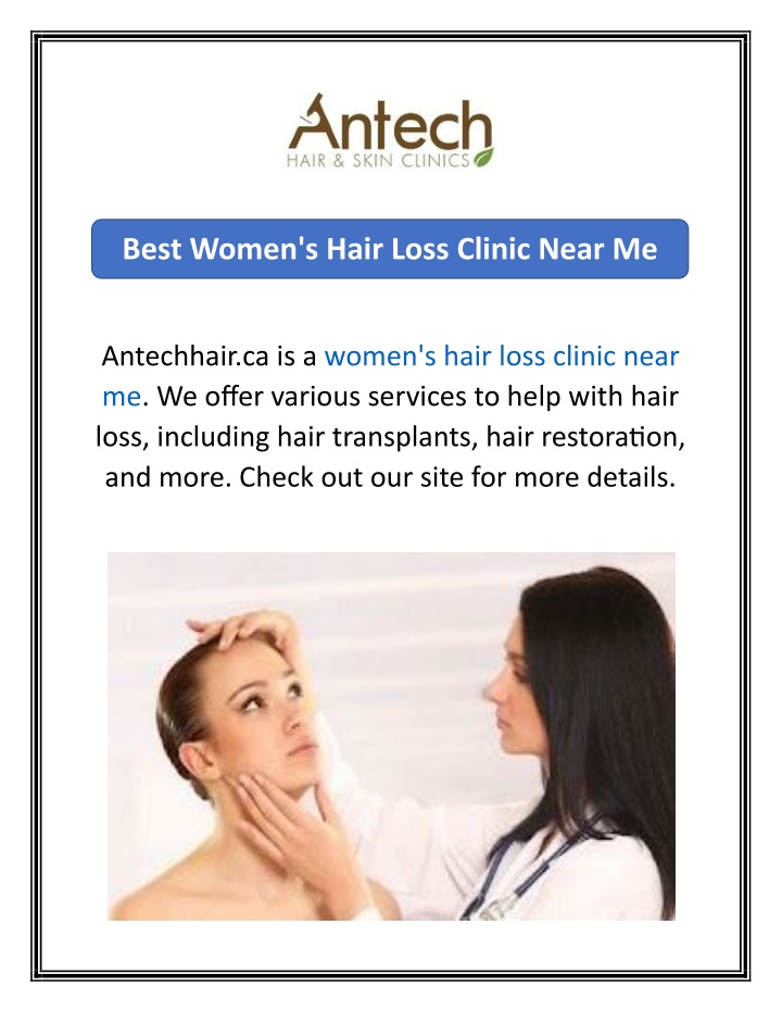 best women s hair loss clinic near me