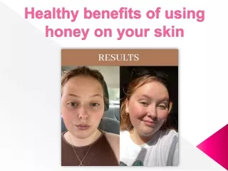 Healthy benefits of using honey on your skin