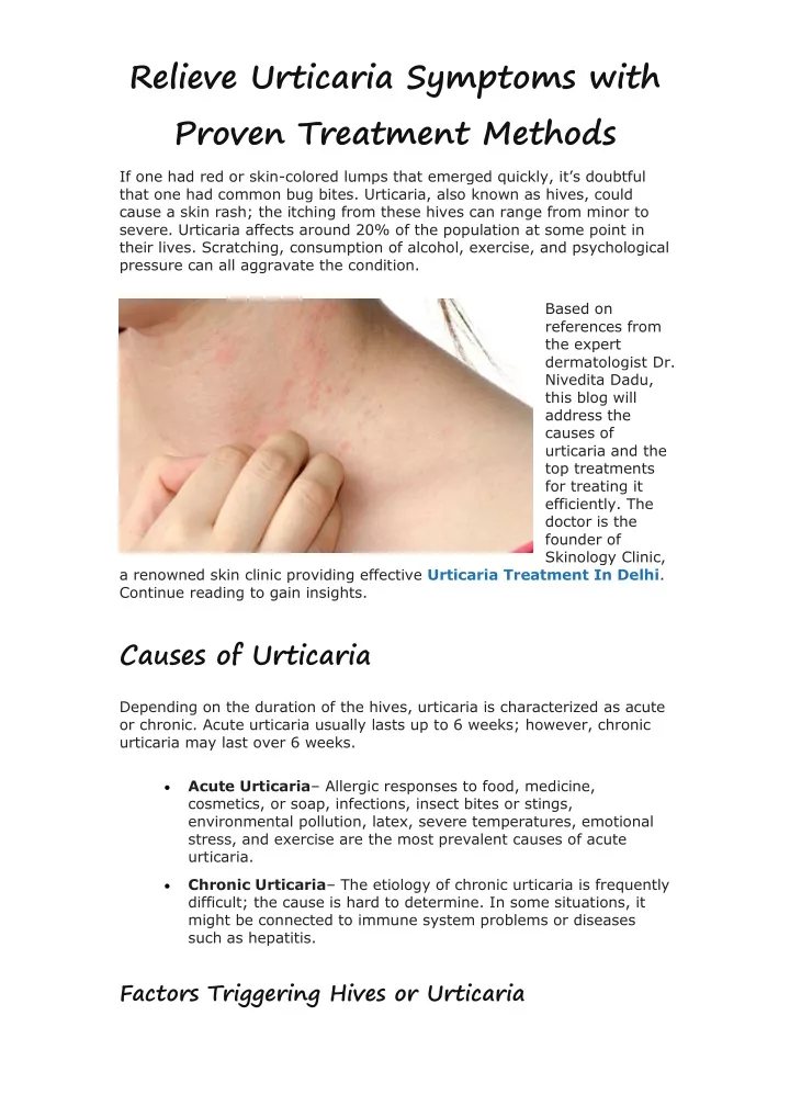 relieve urticaria symptoms with proven treatment