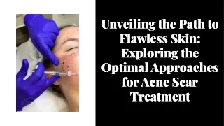 Exploring the Optimal Approaches for Acne Scar treatment