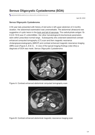 Serous Oligocystic Cystadenoma SOA