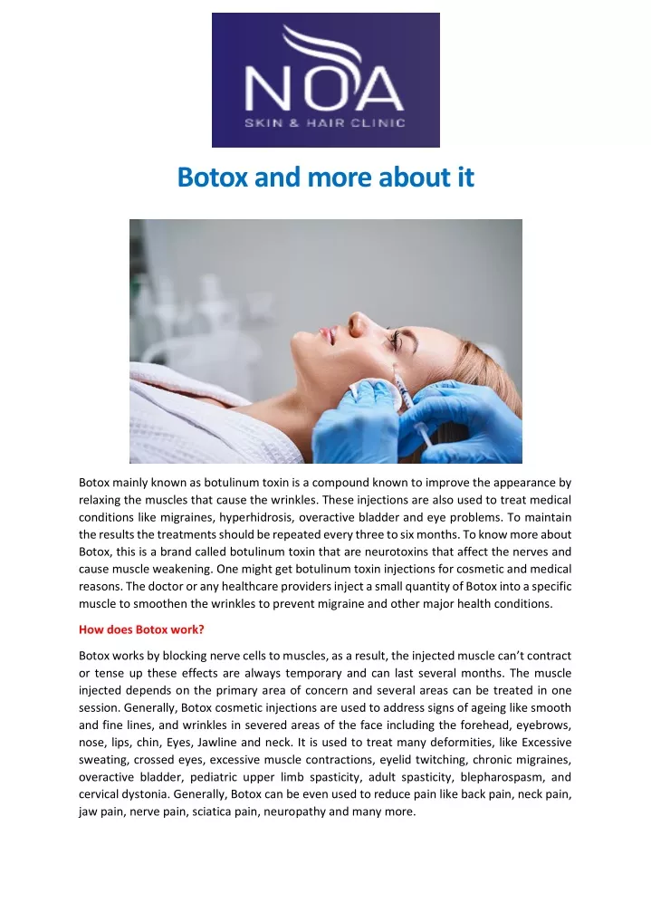 botox and more about it