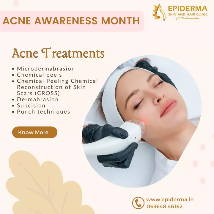 acne awareness month