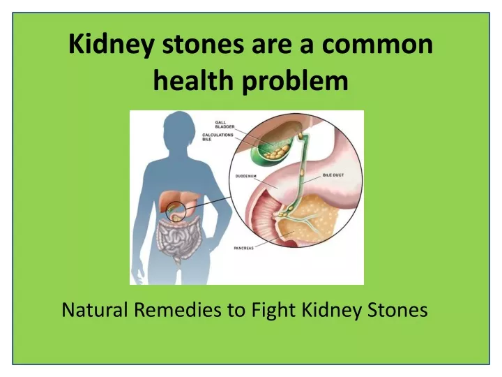 kidney stones are a common health problem