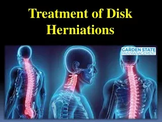 Treatment of Disk Herniations