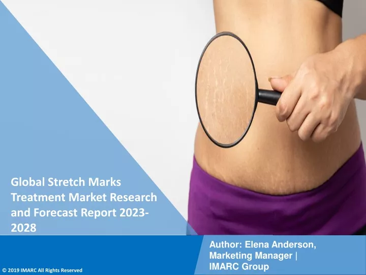 global stretch marks treatment market research