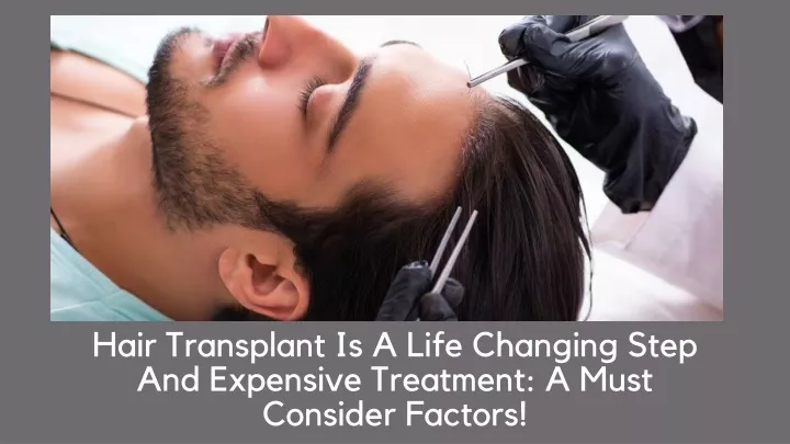 hair transplant is a life changing step