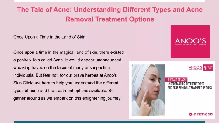 the tale of acne understanding different types