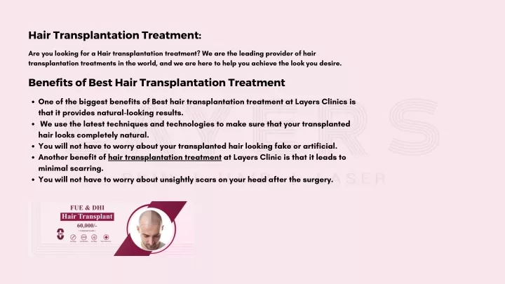 hair transplantation treatment