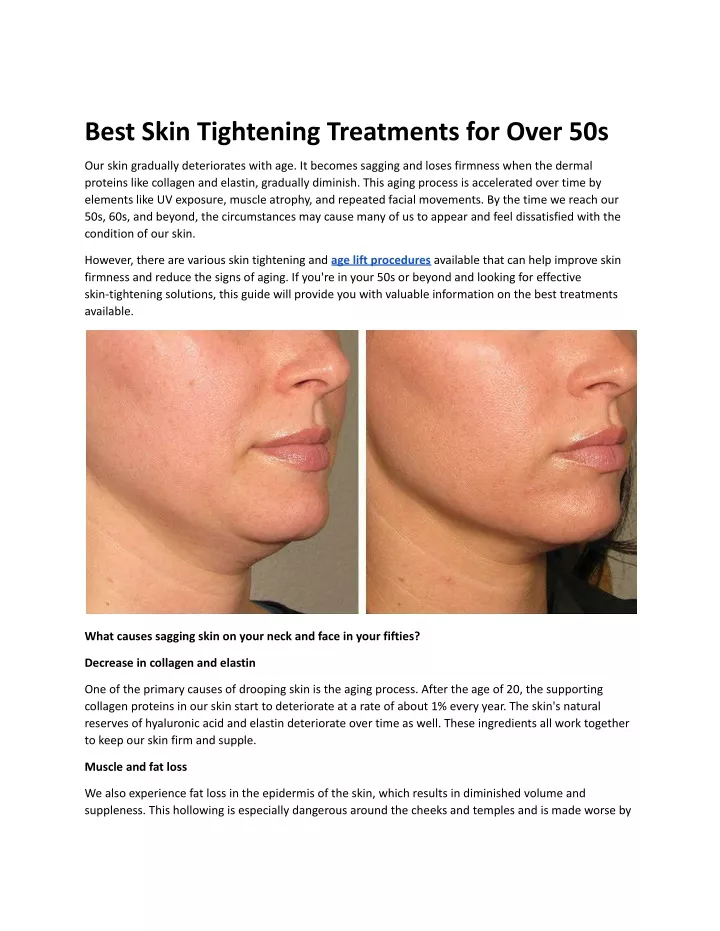 best skin tightening treatments for over 50s