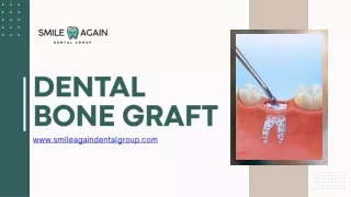 Dental Bone Graft at Smile Again Dental Group